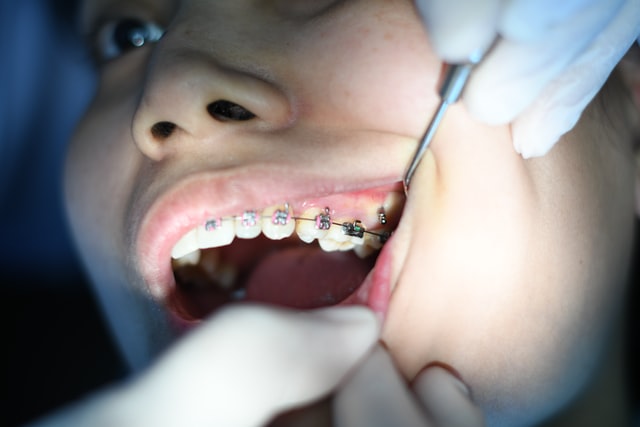 pregled pri zobozdravniku